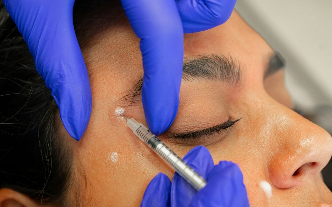 Avoiding And Correcting Uneven Botox Results