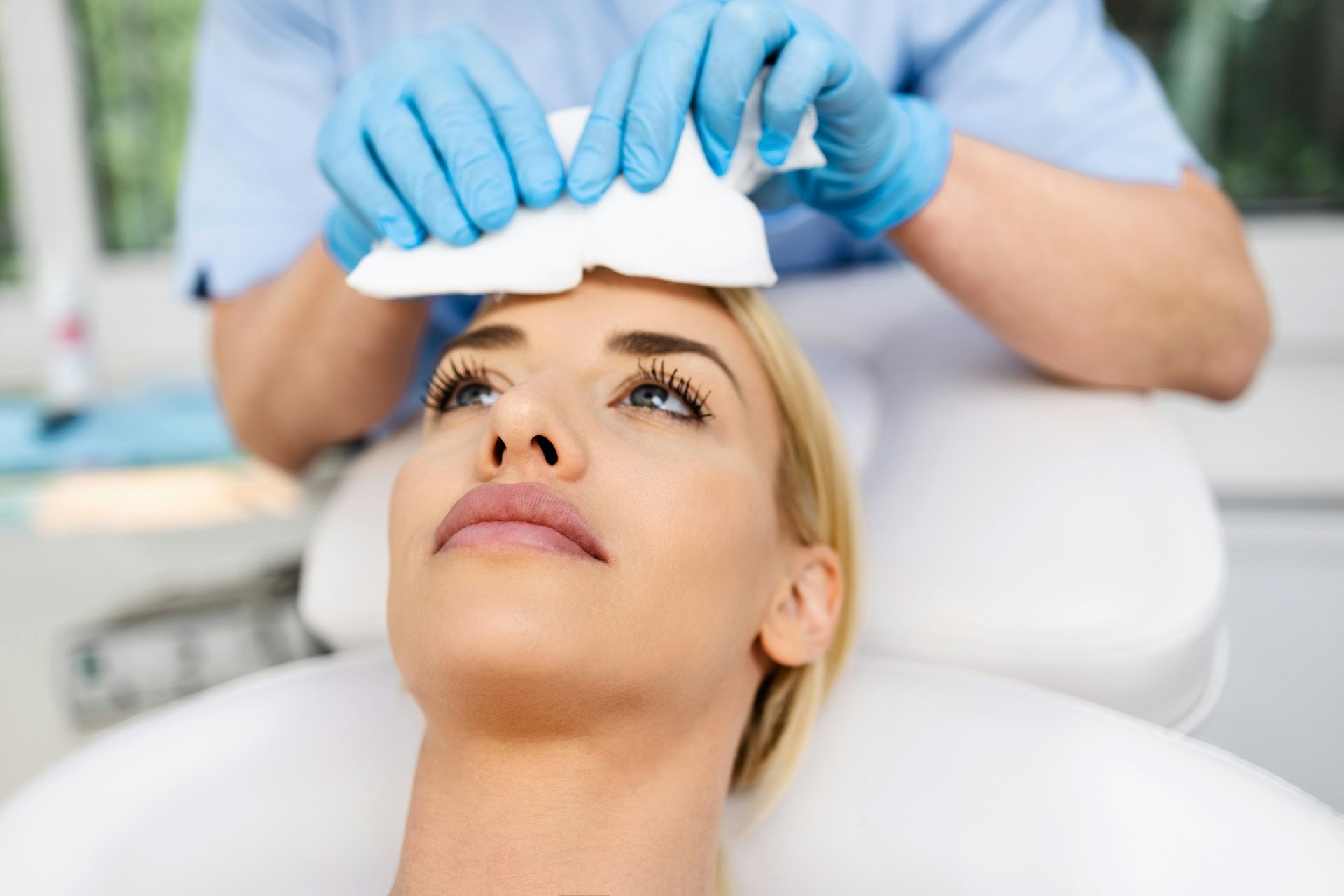 microneedling