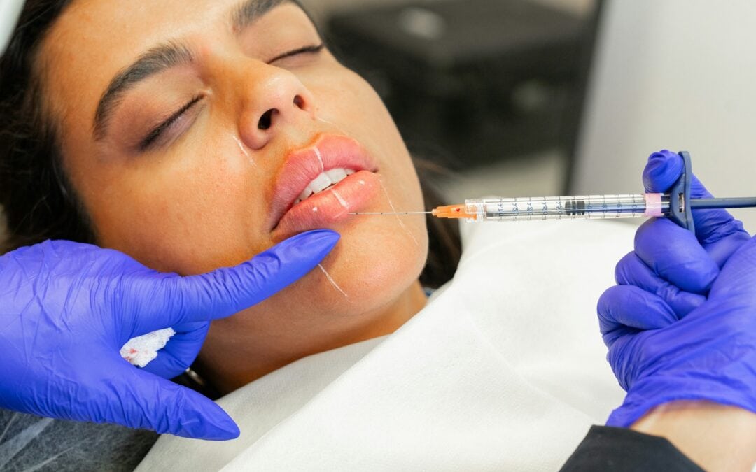 Correcting Dermal Fillers Gone Wrong