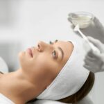 microneedling
