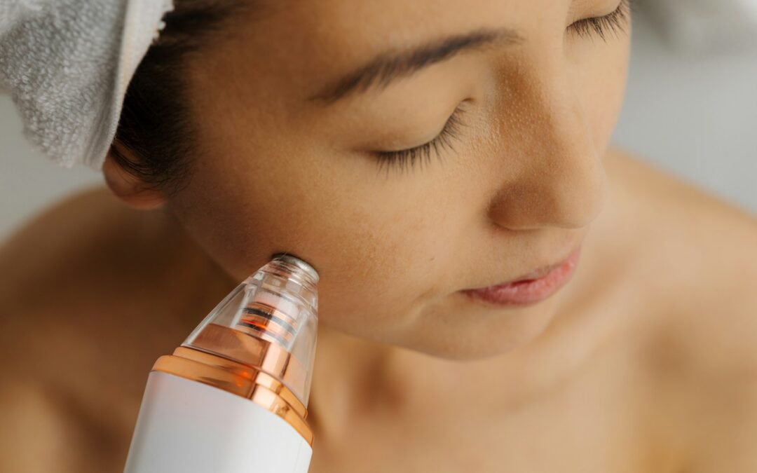 Effective Tips for Post-Microneedling Recovery