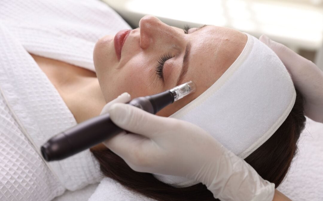 How Microneedling in Austin Supports Spring Skin Recovery