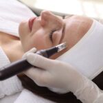 Microneedling