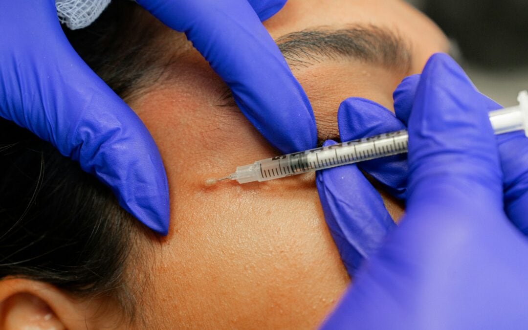 Understanding the Purpose Behind Filler and What It Does