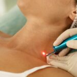 Laser and Light Treatments