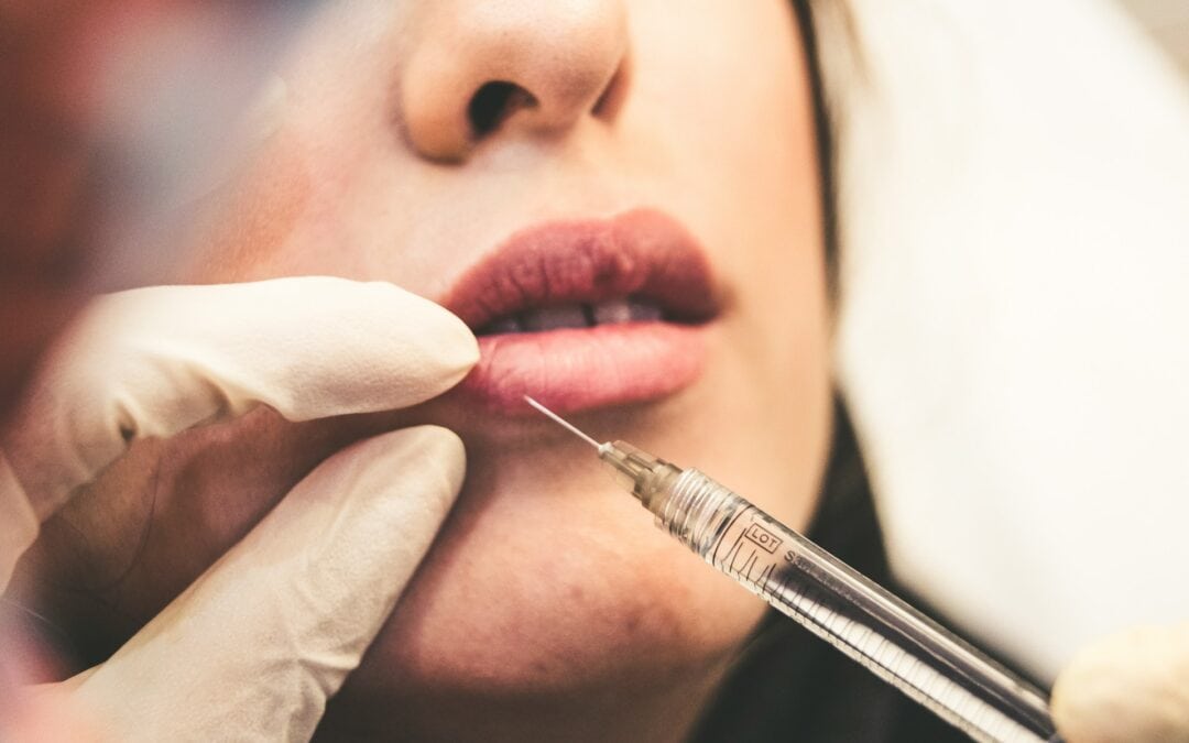 Everything to Know Before Getting Lip Filler in Austin