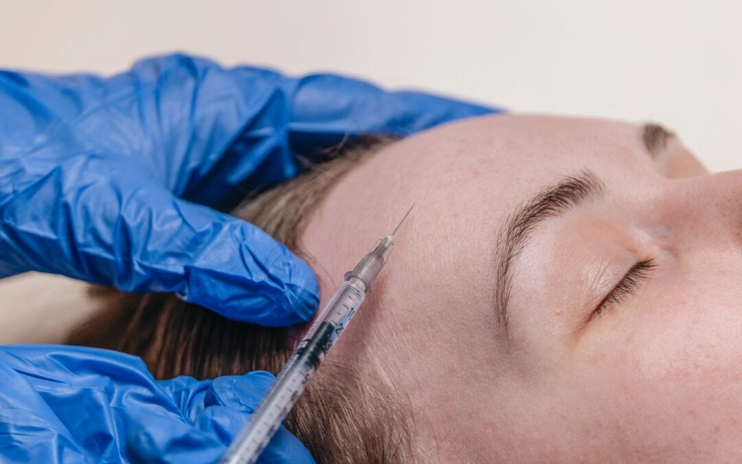 How Summer Impacts Your Skin if Using Dermal Fillers Injections